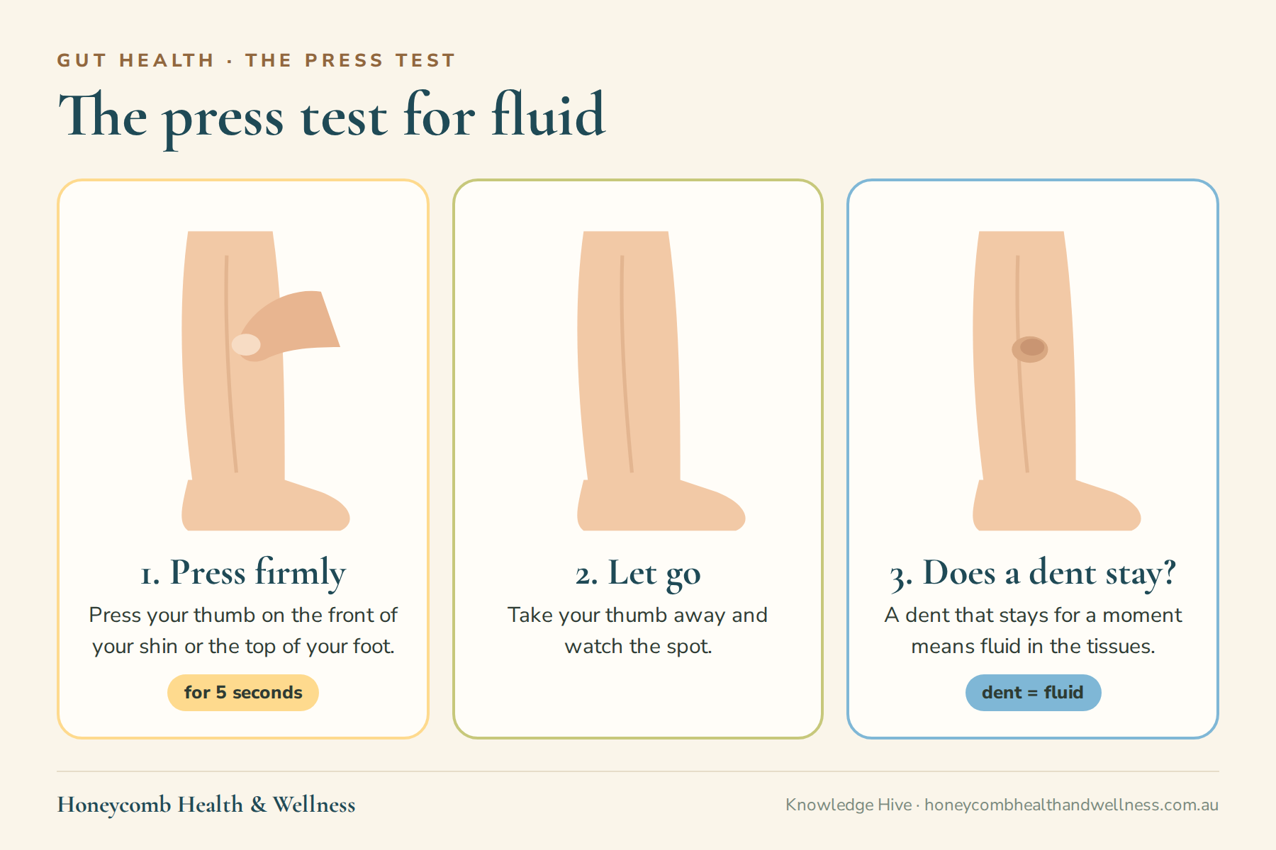 The press test for fluid: press your thumb on your shin for five seconds, let go, and a dent that stays means fluid in the tissues